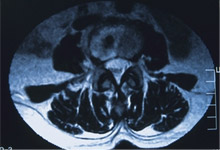 Image of umbilical region cross-section