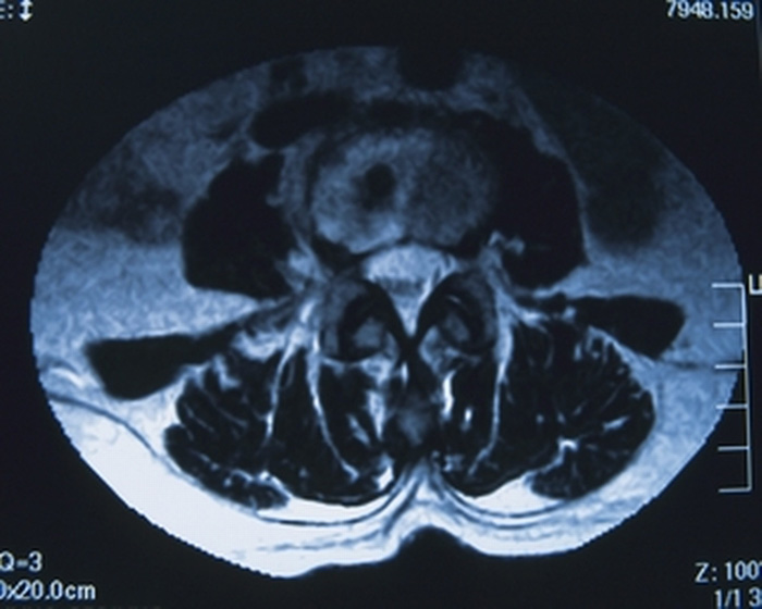 Image of umbilical region cross-section